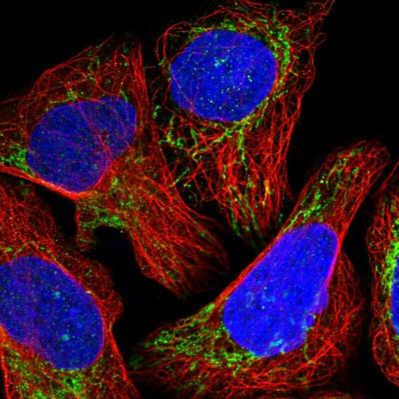 NDUFB11 Antibody - BSA Free Immunocytochemistry/ Immunofluorescence: NDUFB11 Antibody [NBP1-83956]