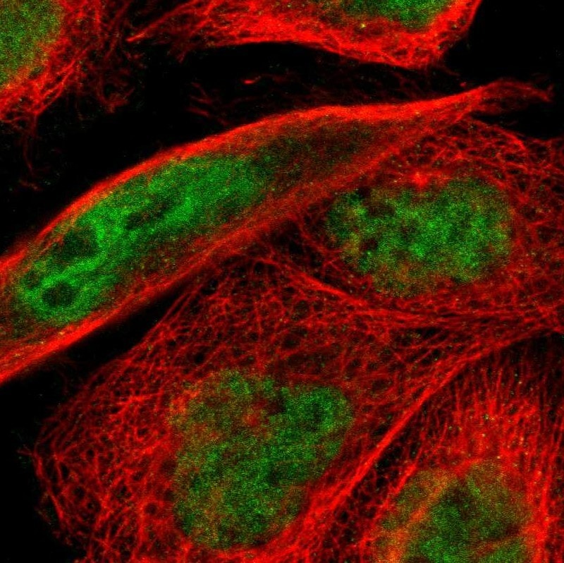 ELK3 Antibody - BSA Free Immunocytochemistry/ Immunofluorescence: ELK3 Antibody [NBP1-83960]