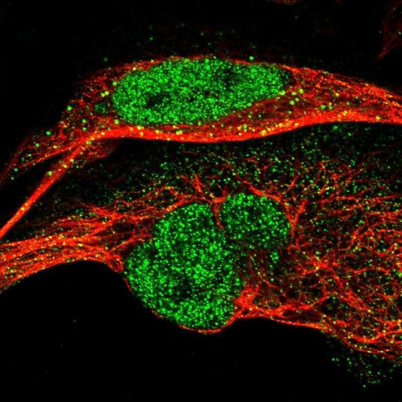ERGIC1 Antibody - BSA Free Immunocytochemistry/ Immunofluorescence: ERGIC1 Antibody [NBP1-83962]