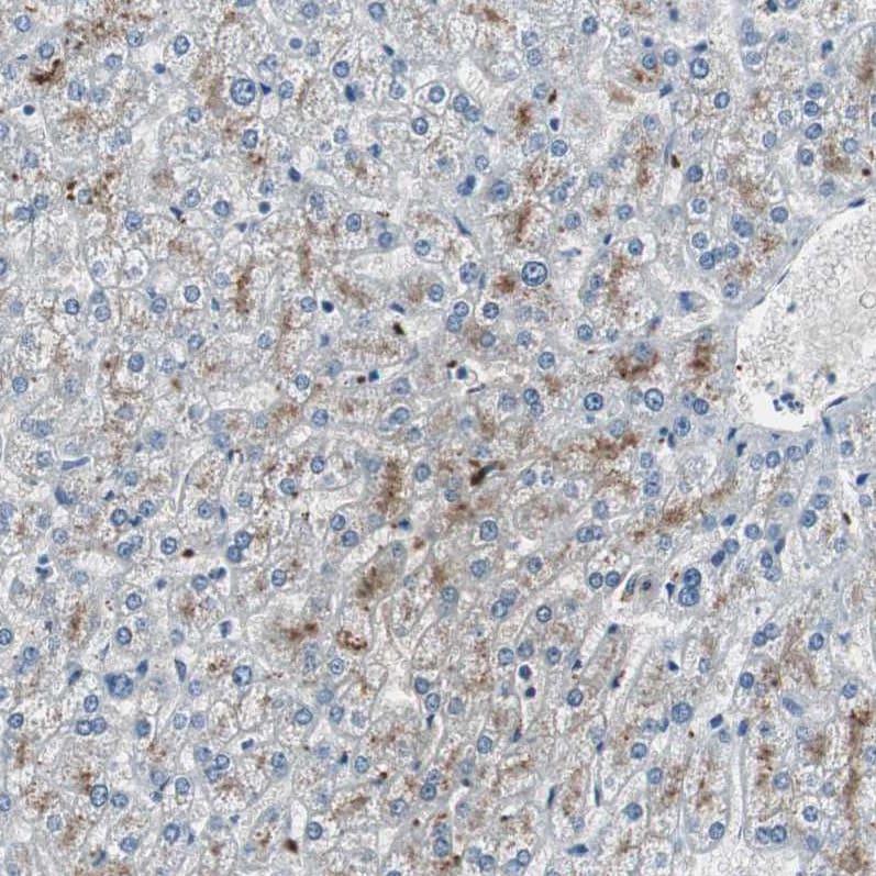 Serpin F1/PEDF Antibody - BSA Free Immunohistochemistry-Paraffin: Serpin F1/PEDF Antibody - BSA Free [NBP1-83972]