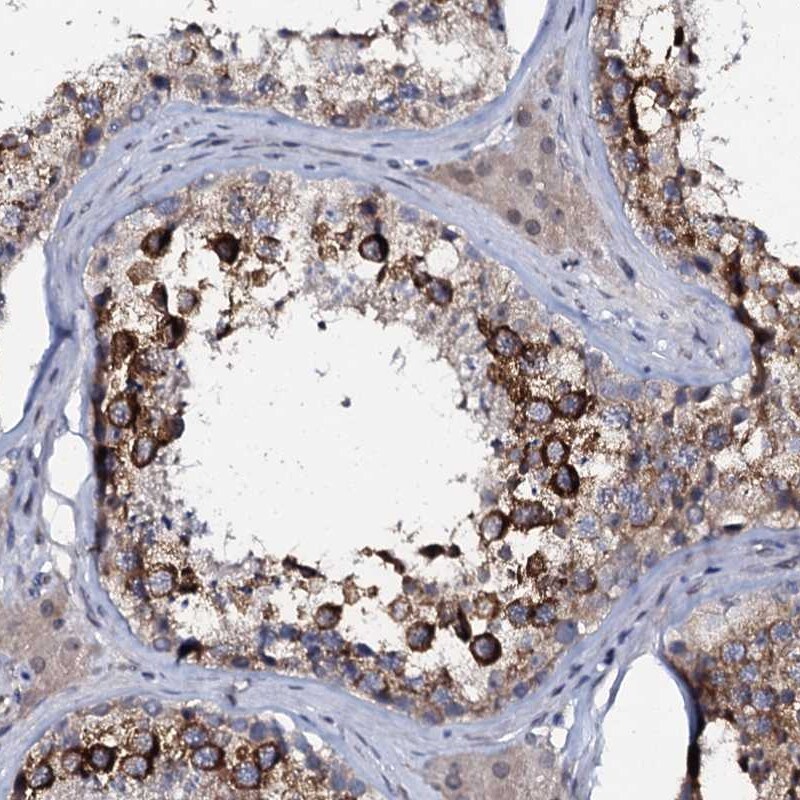 C10orf88 Antibody - BSA Free Immunohistochemistry: C10orf88 Antibody - BSA Free [NBP1-83978]