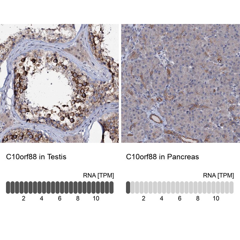 C10orf88 Antibody - BSA Free Immunohistochemistry: C10orf88 Antibody - BSA Free [NBP1-83978]