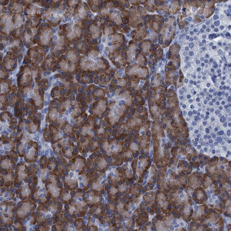 C10orf88 Antibody - BSA Free Immunohistochemistry-Paraffin: C10orf88 Antibody [NBP1-83979]