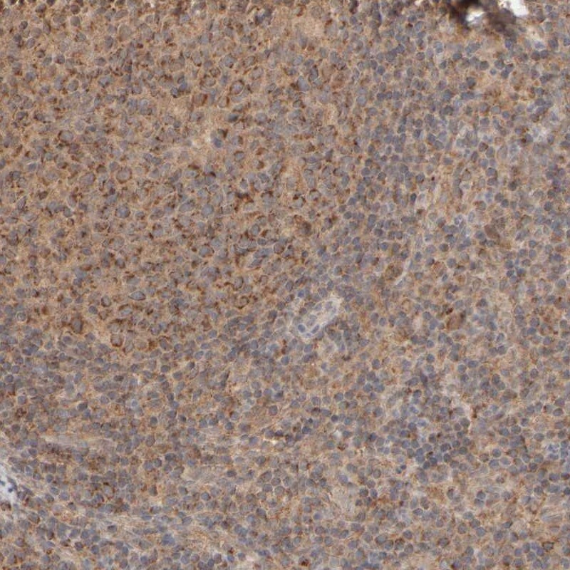eIF2B3 Antibody - BSA Free Immunohistochemistry-Paraffin: eIF2B3 Antibody - BSA Free [NBP1-83987]