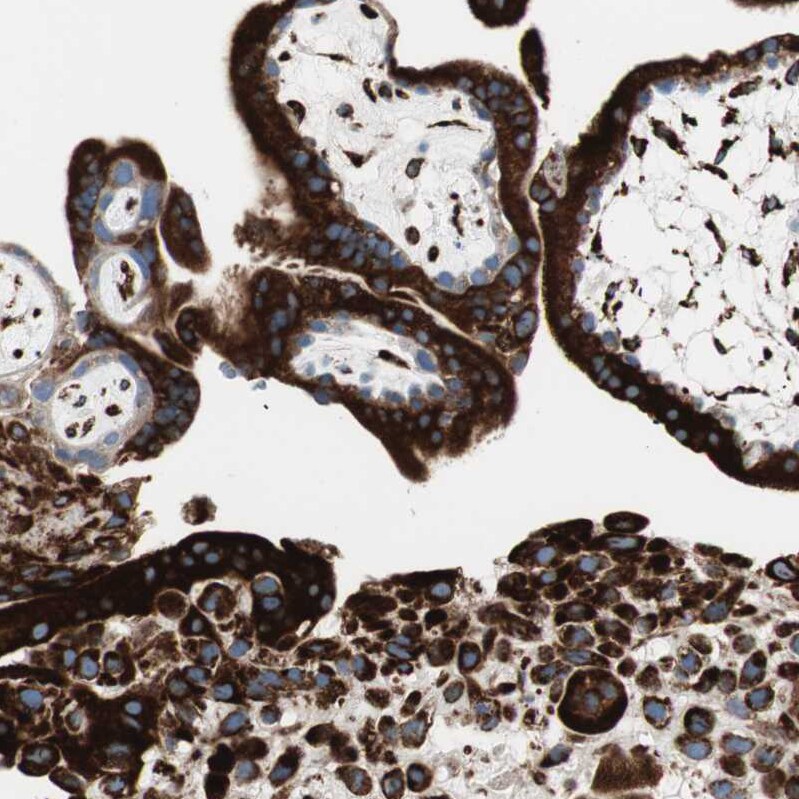PHD4/HIF Prolyl Hydroxylase 4 Antibody - BSA Free Immunohistochemistry-Paraffin: PHD4/HIF Prolyl Hydroxylase 4 Antibody - BSA Free [NBP1-83989]