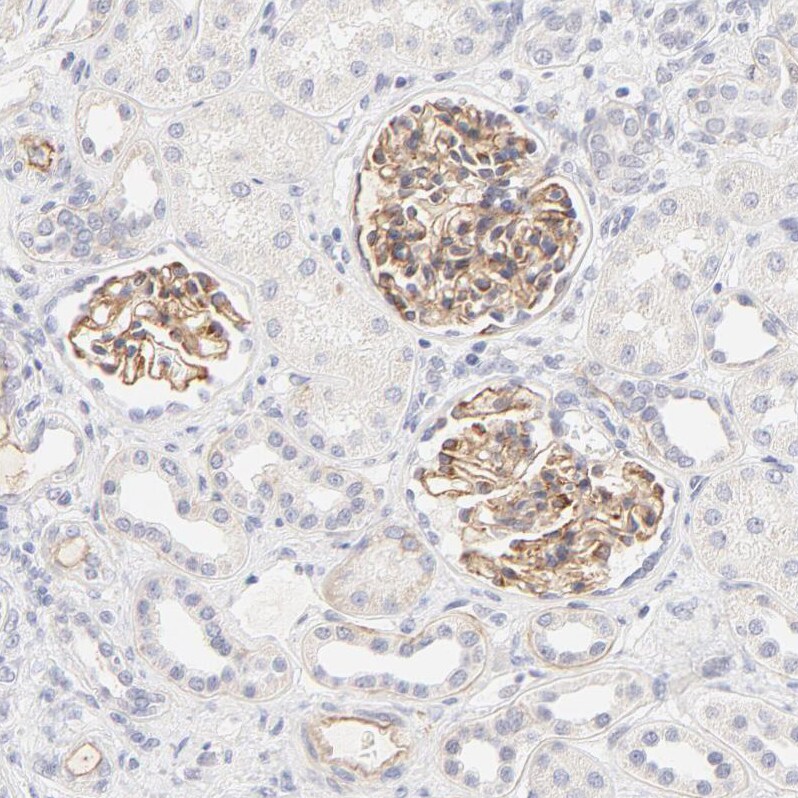 Nephronectin Antibody - BSA Free Immunohistochemistry: Nephronectin Antibody - BSA Free [NBP1-83990]