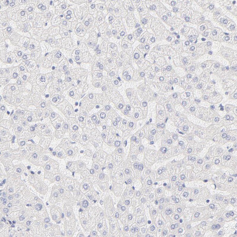 Nephronectin Antibody - BSA Free Immunohistochemistry: Nephronectin Antibody - BSA Free [NBP1-83990]