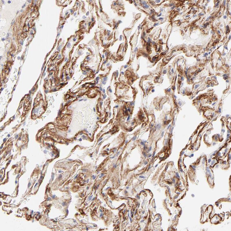 Nephronectin Antibody - BSA Free Immunohistochemistry: Nephronectin Antibody - BSA Free [NBP1-83990]