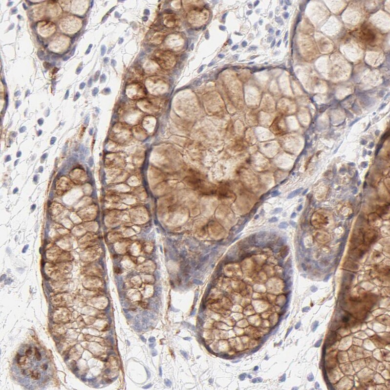 Nephronectin Antibody - BSA Free Immunohistochemistry: Nephronectin Antibody - BSA Free [NBP1-83990]