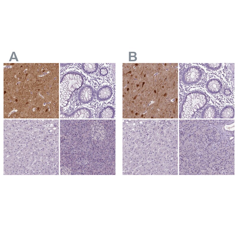 NECAB1 Antibody - BSA Free Immunohistochemistry-Paraffin: NECAB1 Antibody [NBP1-84003]