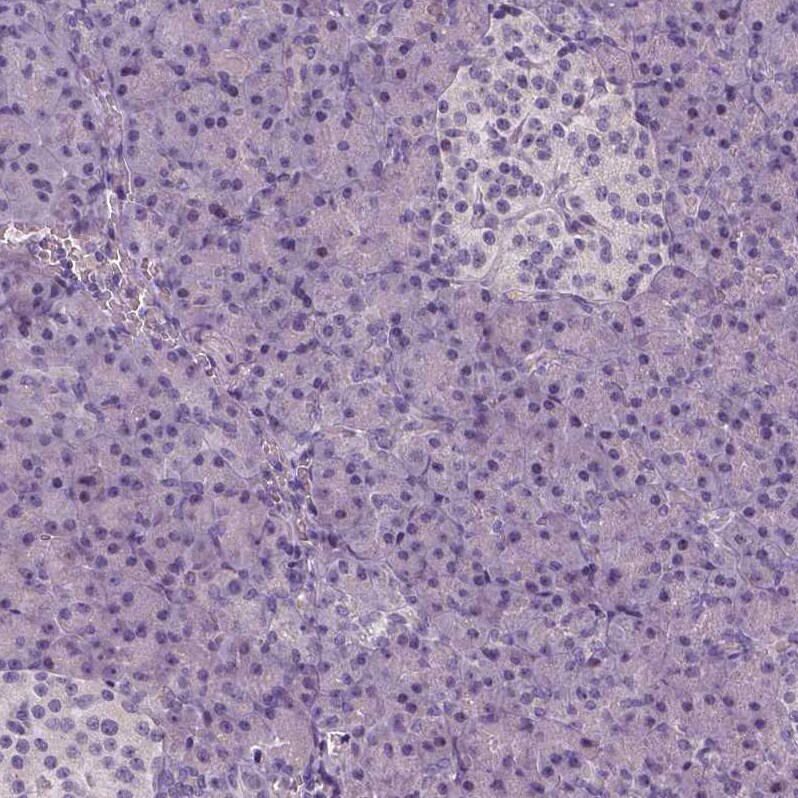 NECAB1 Antibody - BSA Free Immunohistochemistry-Paraffin: NECAB1 Antibody - BSA Free [NBP1-84003]