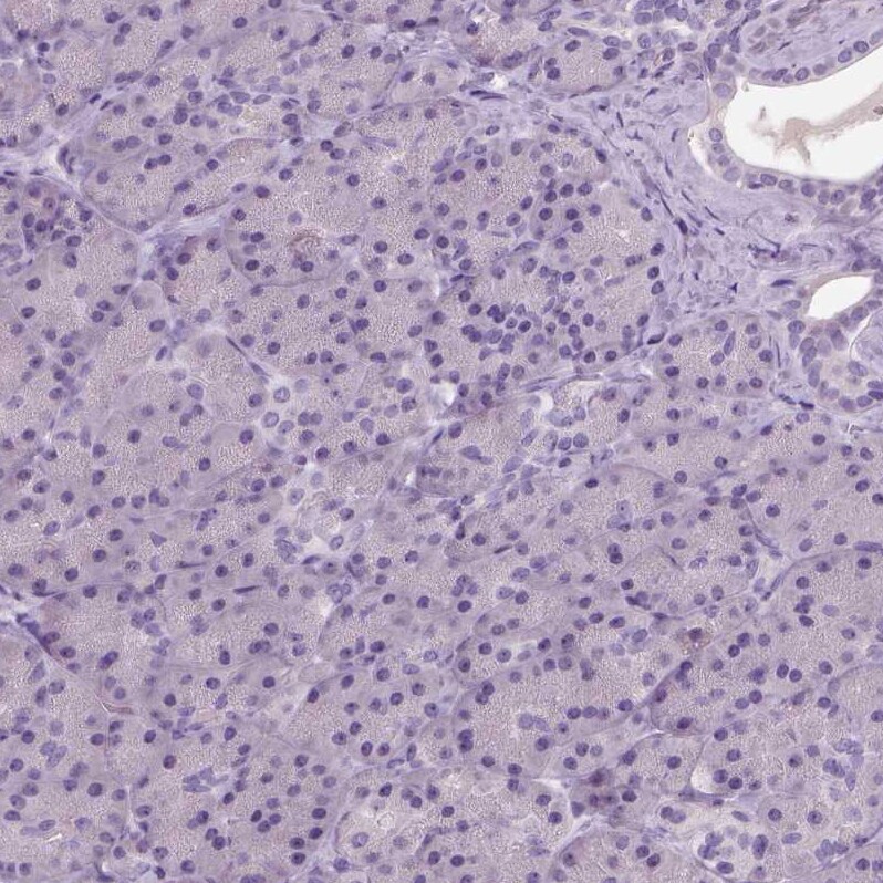 NECAB1 Antibody - BSA Free Immunohistochemistry-Paraffin: NECAB1 Antibody - BSA Free [NBP1-84004]