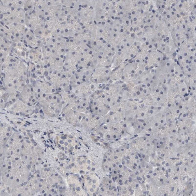 NECAB1 Antibody - BSA Free Immunohistochemistry-Paraffin: NECAB1 Antibody - BSA Free [NBP1-84005]