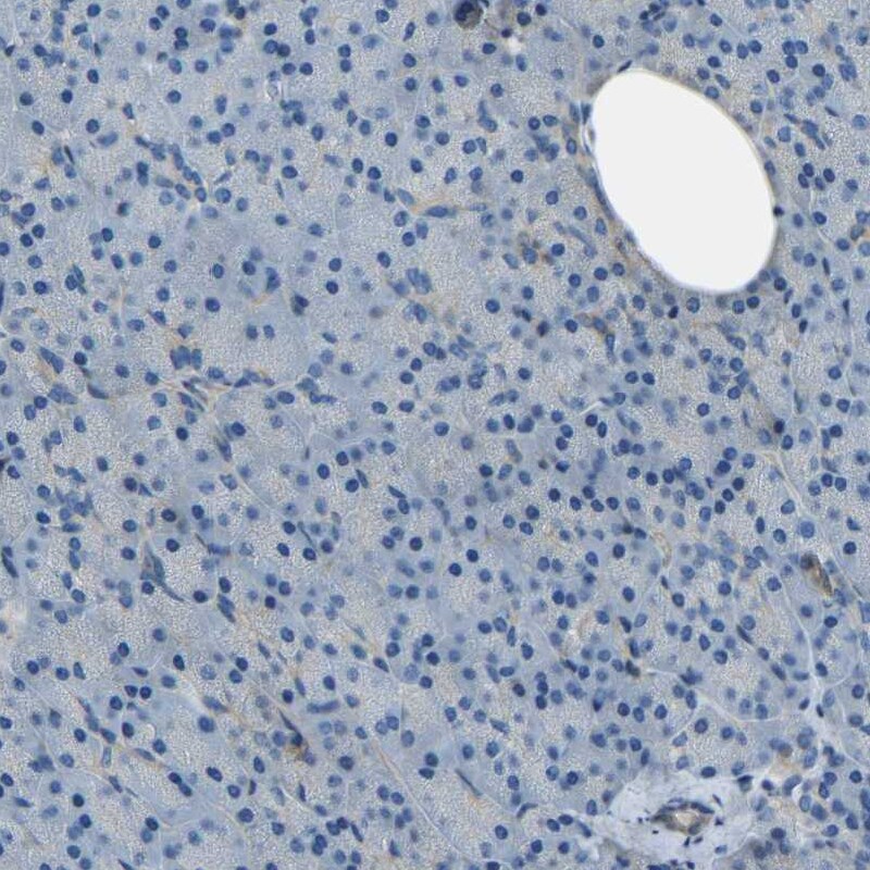 Collagen III alpha 1/COL3A1 Antibody - BSA Free Immunohistochemistry-Paraffin: Collagen III alpha 1/COL3A1 Antibody - BSA Free [NBP1-84007]