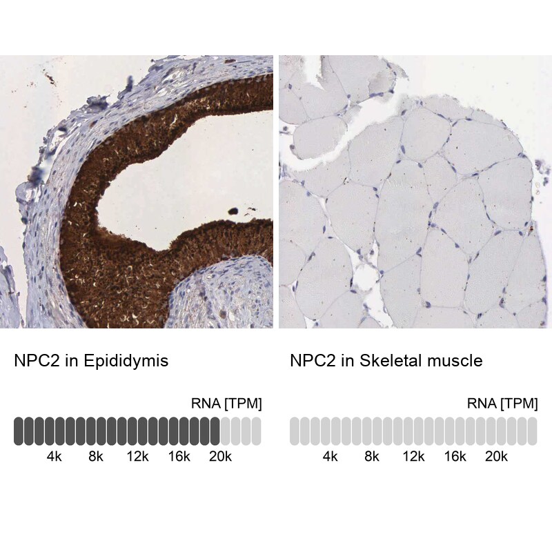 Niemann-Pick type C2 Antibody - BSA Free Immunohistochemistry-Paraffin: Niemann-Pick type C2 Antibody - BSA Free [NBP1-84012]
