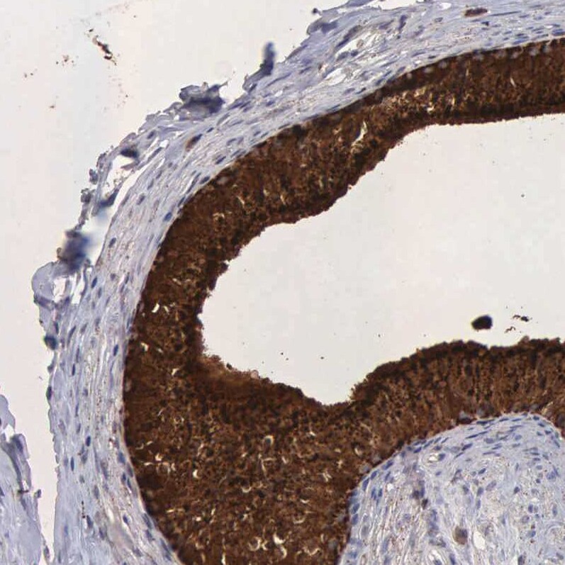 Niemann-Pick type C2 Antibody - BSA Free Immunohistochemistry-Paraffin: Niemann-Pick type C2 Antibody - BSA Free [NBP1-84012]