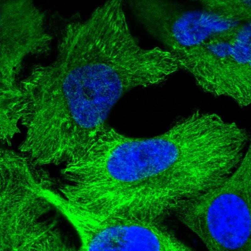 Plectin Antibody - BSA Free Immunocytochemistry/ Immunofluorescence: Plectin Antibody [NBP1-84019]