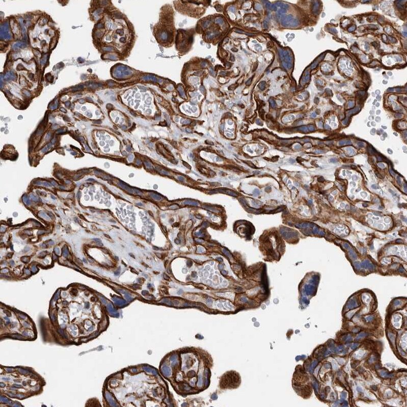 Plectin Antibody - BSA Free Immunohistochemistry-Paraffin: Plectin Antibody - BSA Free [NBP1-84020]