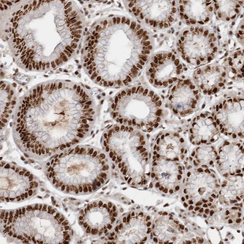 EYA2 Antibody - BSA Free Immunohistochemistry-Paraffin: EYA2 Antibody [NBP1-84026]