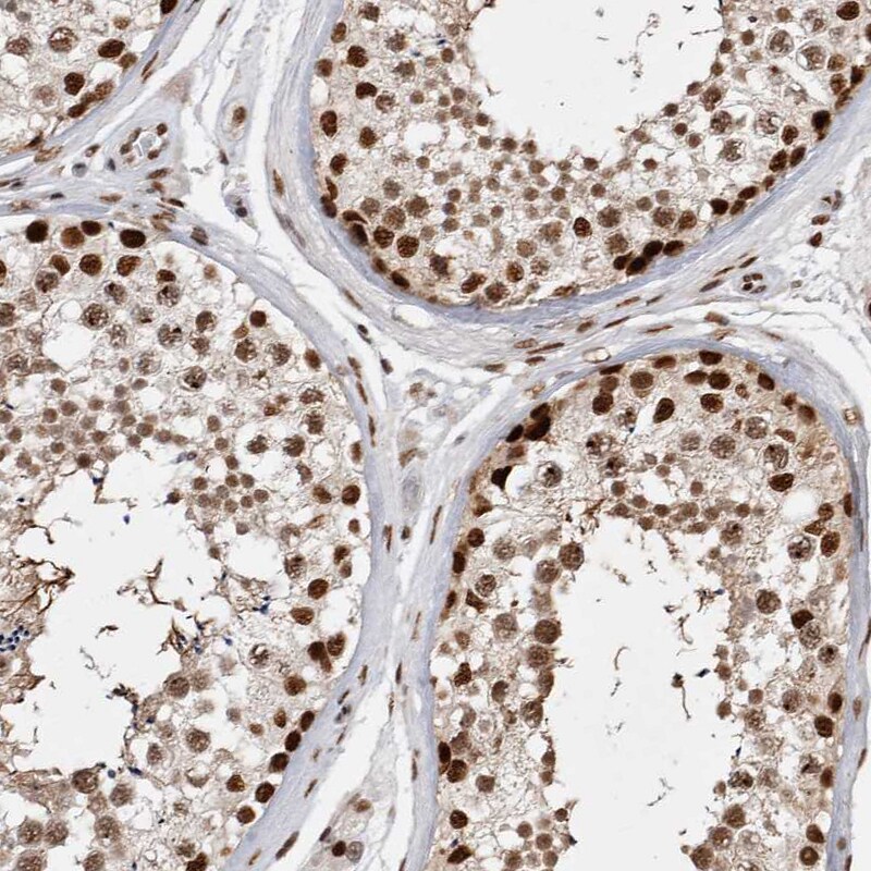 EYA2 Antibody - BSA Free Immunohistochemistry-Paraffin: EYA2 Antibody [NBP1-84026]