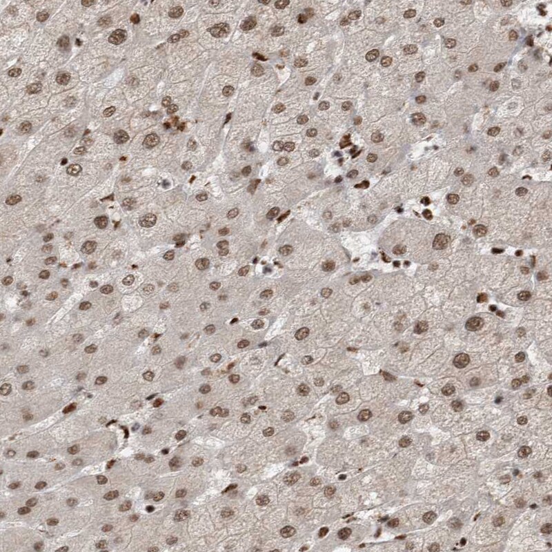 EYA2 Antibody - BSA Free Immunohistochemistry-Paraffin: EYA2 Antibody [NBP1-84026]