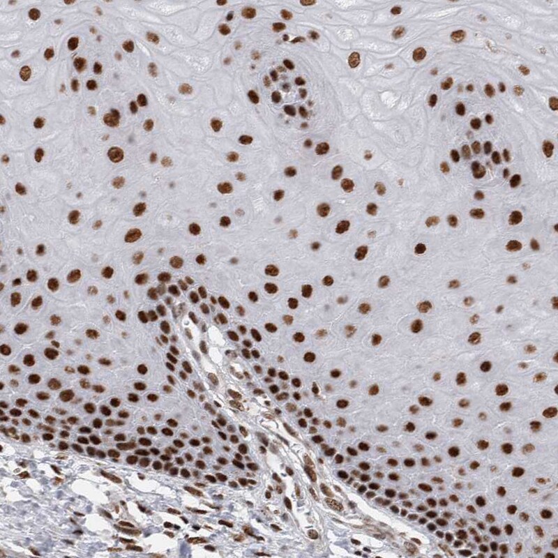 EYA2 Antibody - BSA Free Immunohistochemistry-Paraffin: EYA2 Antibody [NBP1-84026]