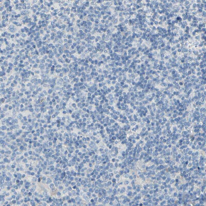 EAAT2/GLT1 Antibody - BSA Free Immunohistochemistry-Paraffin: EAAT2/GLT1 Antibody [NBP1-84027]