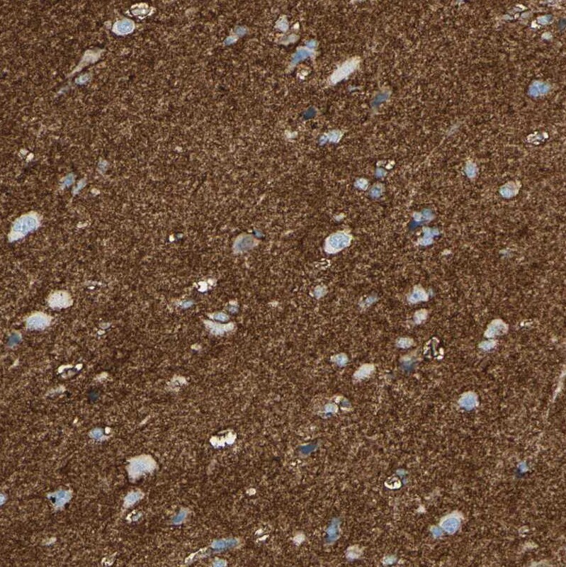 EAAT2/GLT1 Antibody - BSA Free Immunohistochemistry-Paraffin: EAAT2/GLT1 Antibody [NBP1-84027]