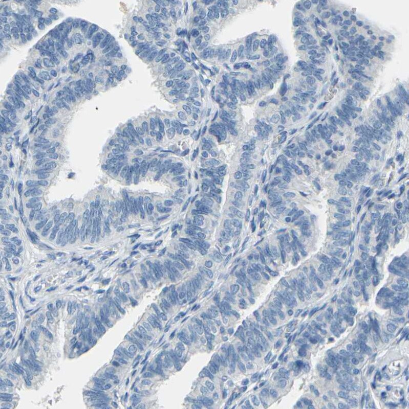 EAAT2/GLT1 Antibody - BSA Free Immunohistochemistry-Paraffin: EAAT2/GLT1 Antibody [NBP1-84027]