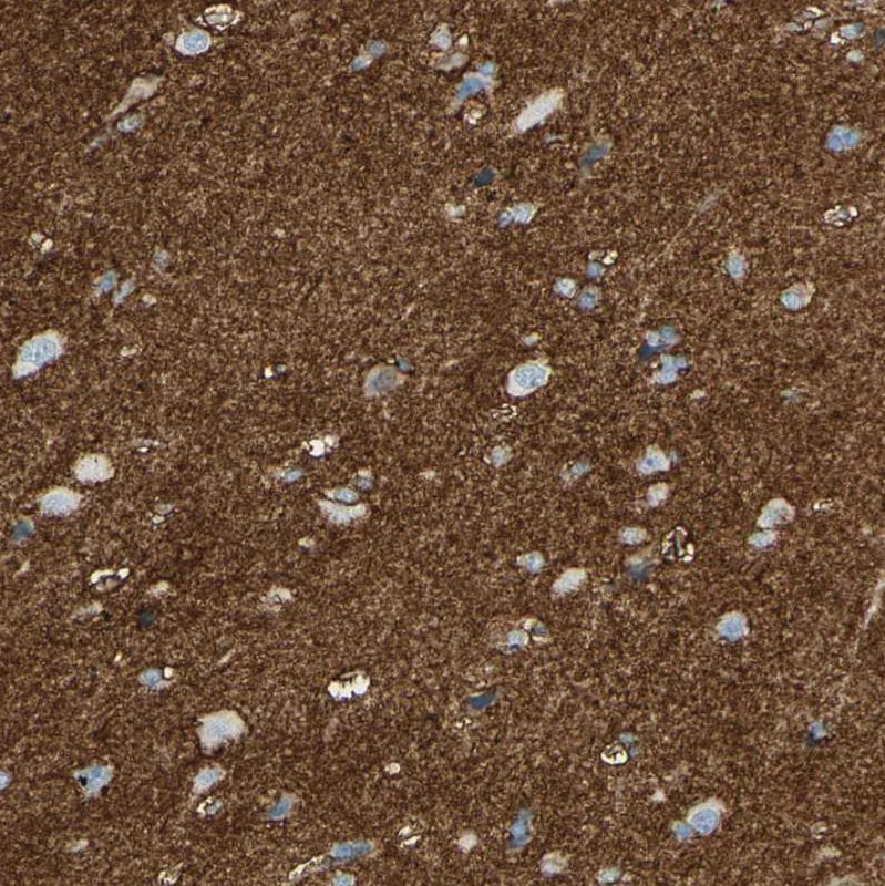 EAAT2/GLT1 Antibody - BSA Free Immunohistochemistry-Paraffin: EAAT2/GLT1 Antibody - BSA Free [NBP1-84027]