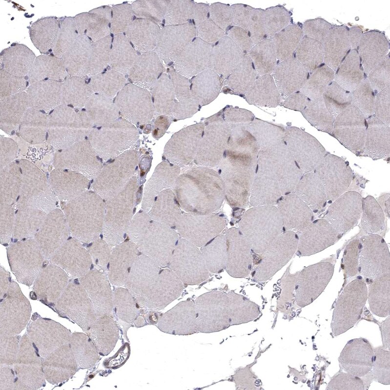 WDR19 Antibody - BSA Free Immunohistochemistry-Paraffin: WDR19 Antibody - BSA Free [NBP1-84033]