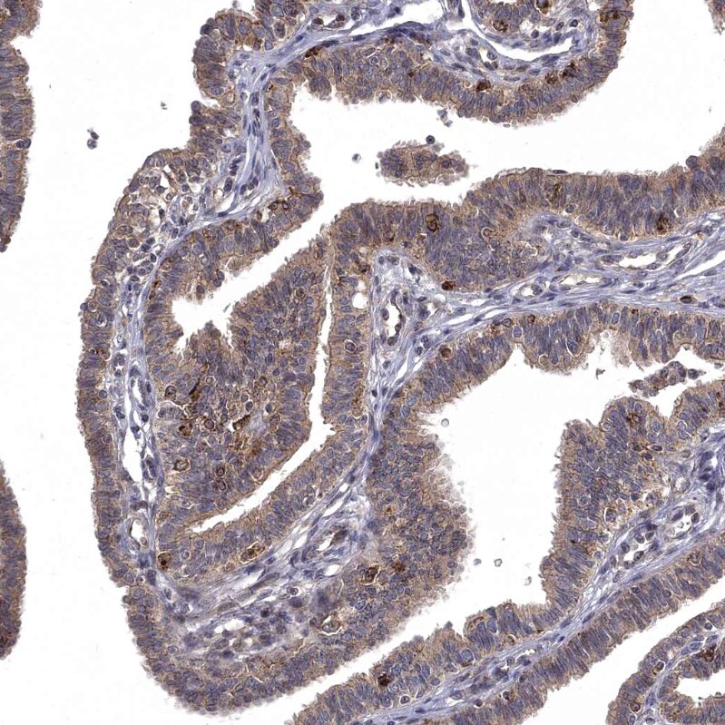 WDR19 Antibody - BSA Free Immunohistochemistry-Paraffin: WDR19 Antibody - BSA Free [NBP1-84033]