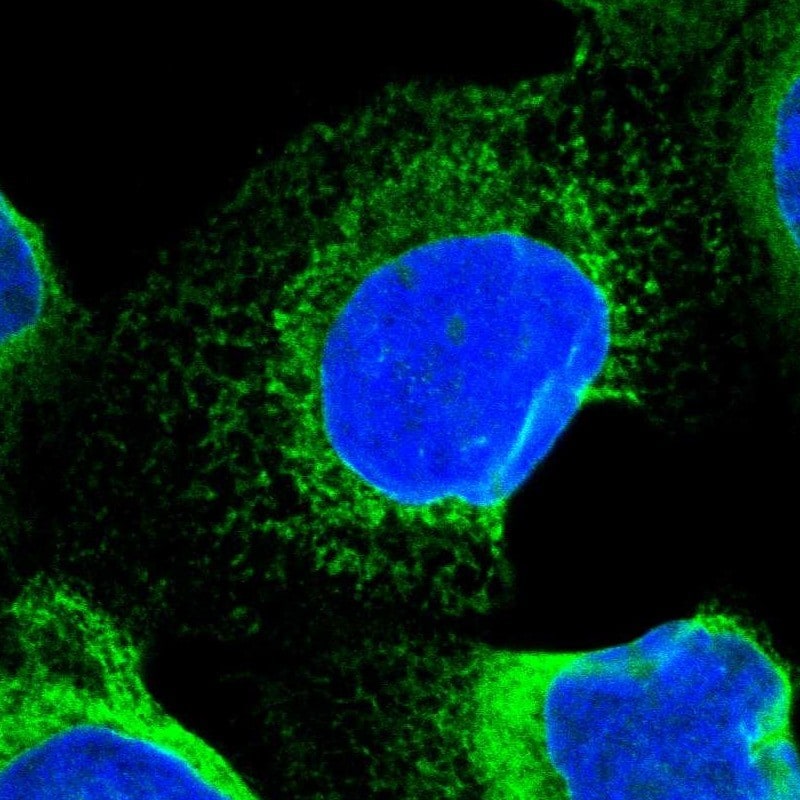 SEC62 Antibody - BSA Free Immunocytochemistry/ Immunofluorescence: SEC62 Antibody [NBP1-84045]