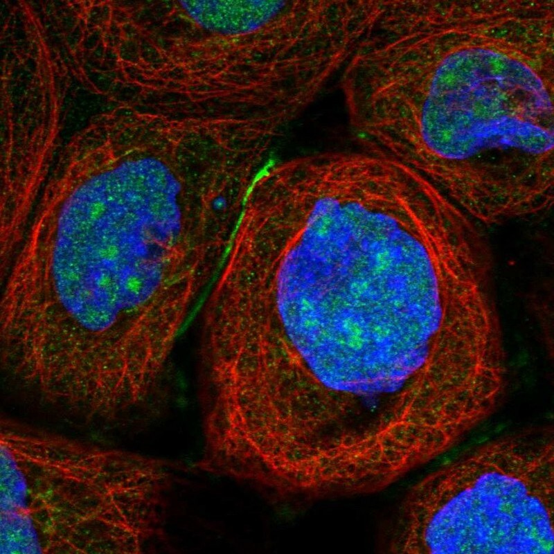 TSR2 Antibody - BSA Free Immunocytochemistry/ Immunofluorescence: TSR2 Antibody [NBP1-84050]