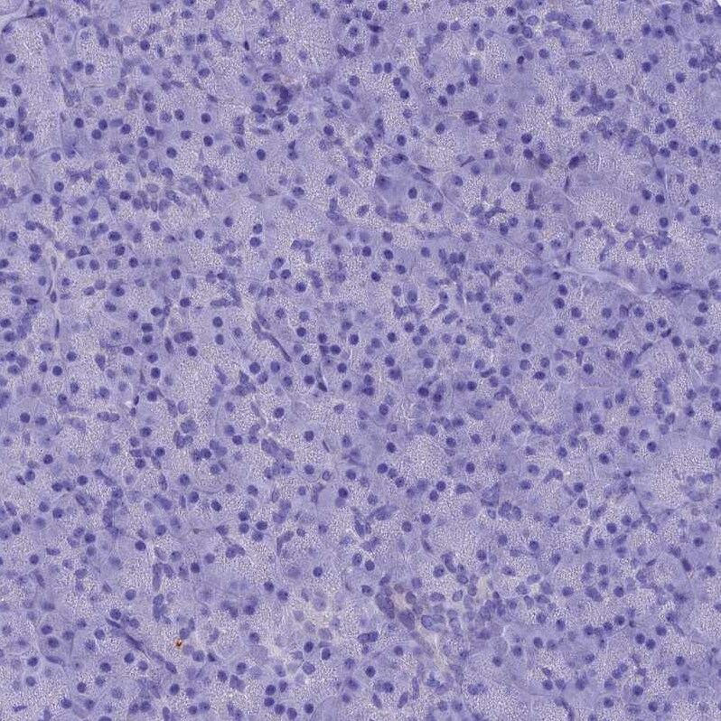 IGSF6/DORA Antibody - BSA Free Immunohistochemistry-Paraffin: IGSF6/DORA Antibody - BSA Free [NBP1-84061]