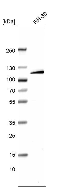 DOC1 Antibody - BSA Free Western Blot: DOC1 Antibody - BSA Free [NBP1-84064]