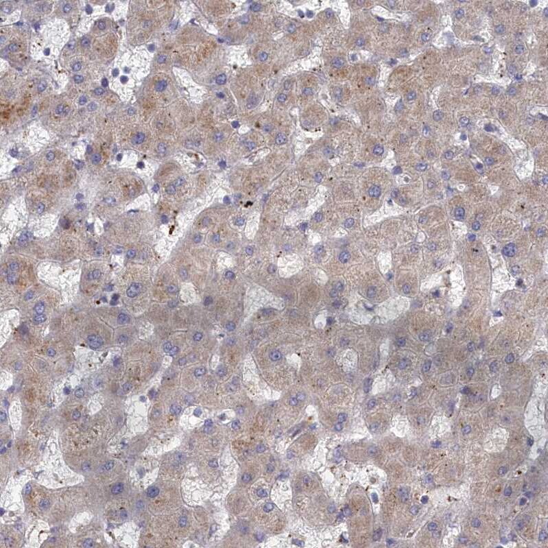 DOC1 Antibody - BSA Free Immunohistochemistry-Paraffin: DOC1 Antibody - BSA Free [NBP1-84064]