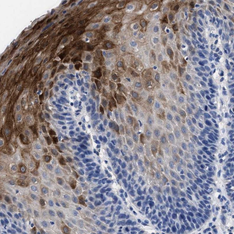 HID1 Antibody - BSA Free Immunohistochemistry-Paraffin: HID1 Antibody - BSA Free [NBP1-84075]