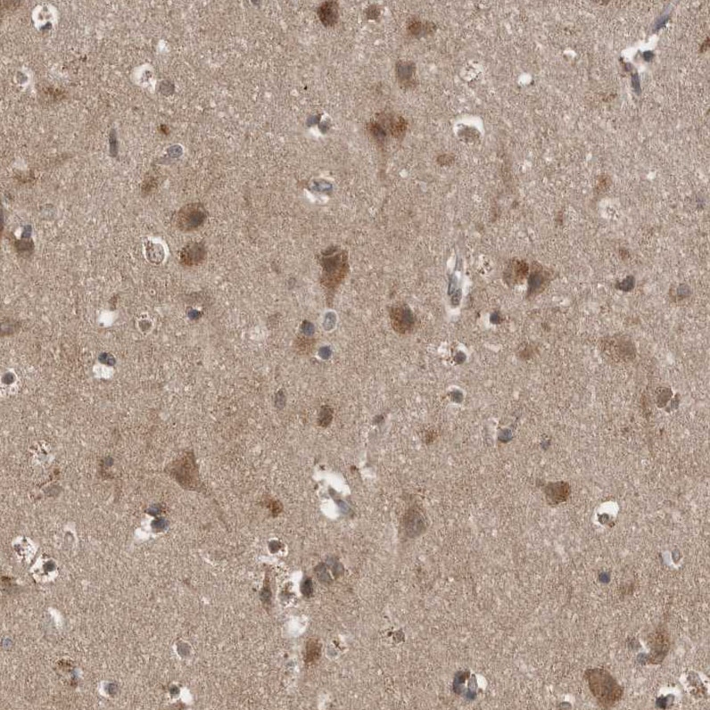 Lgl1 Antibody - BSA Free Immunohistochemistry: Lgl1 Antibody - BSA Free [NBP1-84078]