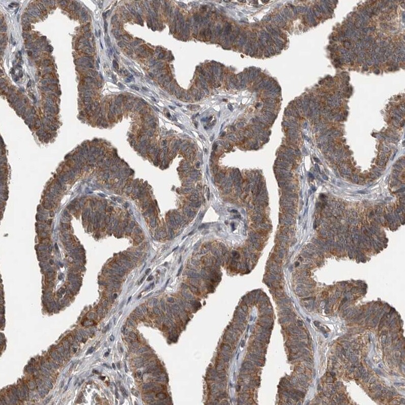 Lgl1 Antibody - BSA Free Immunohistochemistry: Lgl1 Antibody - BSA Free [NBP1-84078]