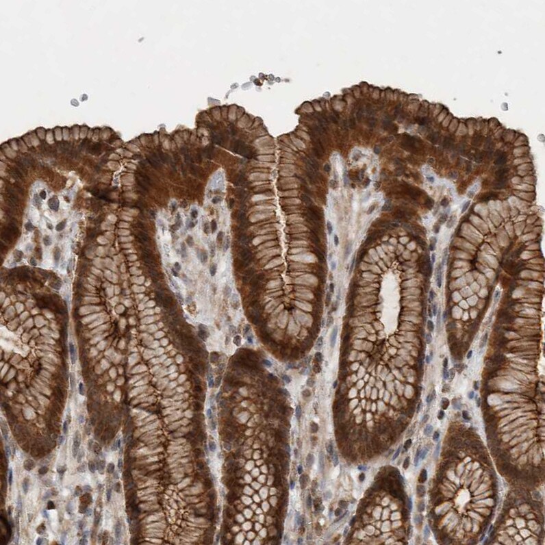 Lgl1 Antibody - BSA Free Immunohistochemistry: Lgl1 Antibody - BSA Free [NBP1-84078]
