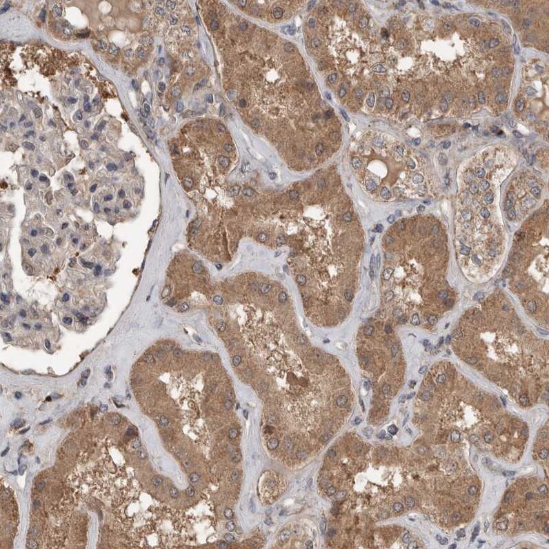 Lgl1 Antibody - BSA Free Immunohistochemistry: Lgl1 Antibody - BSA Free [NBP1-84078]