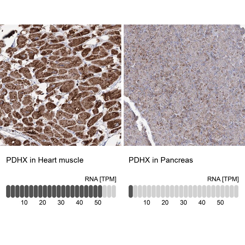 PDHX Antibody - BSA Free Immunohistochemistry-Paraffin: PDHX Antibody - BSA Free [NBP1-84080]