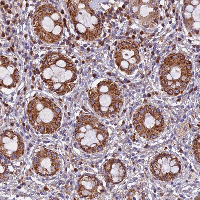EDAR Antibody - BSA Free Immunohistochemistry-Paraffin: EDAR Antibody - BSA Free [NBP1-84081]