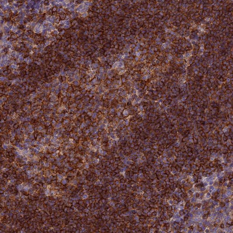 EDAR Antibody - BSA Free Immunohistochemistry-Paraffin: EDAR Antibody - BSA Free [NBP1-84081]
