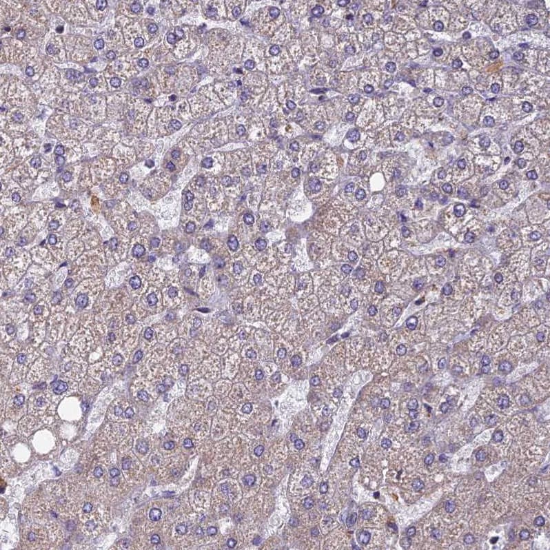 EDAR Antibody - BSA Free Immunohistochemistry-Paraffin: EDAR Antibody - BSA Free [NBP1-84081]