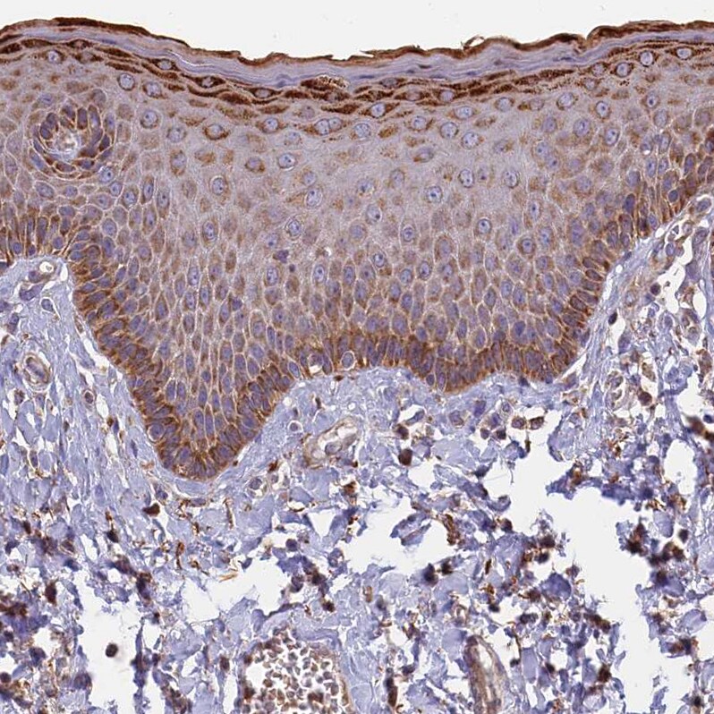 EDAR Antibody - BSA Free Immunohistochemistry-Paraffin: EDAR Antibody - BSA Free [NBP1-84081]