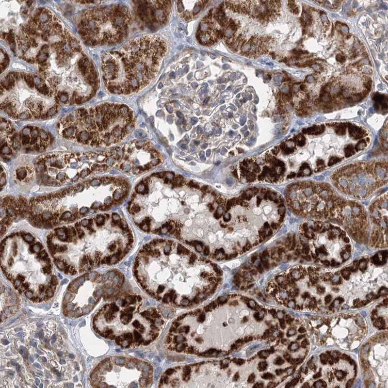 DHTKD1 Antibody - BSA Free Immunohistochemistry-Paraffin: DHTKD1 Antibody [NBP1-84087]
