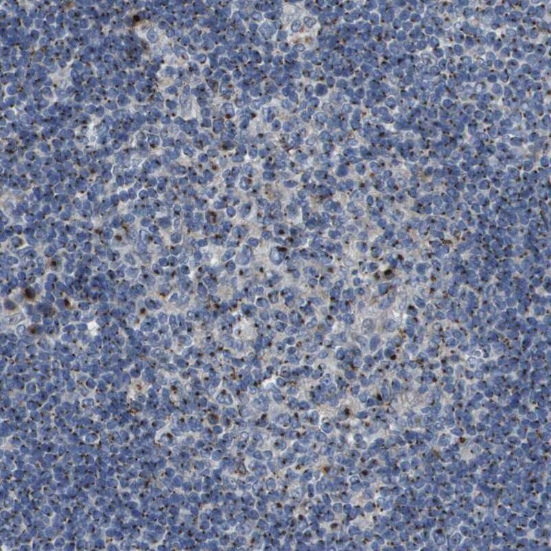 QSOX2 Antibody - BSA Free Immunohistochemistry-Paraffin: QSOX2 Antibody - BSA Free [NBP1-84094]