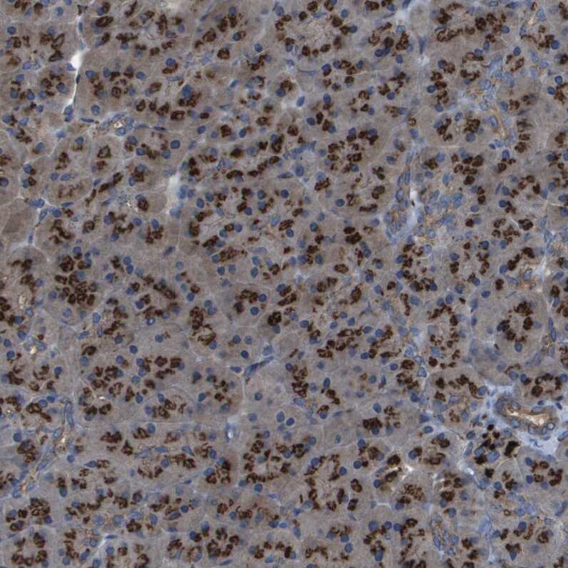 QSOX2 Antibody - BSA Free Immunohistochemistry-Paraffin: QSOX2 Antibody - BSA Free [NBP1-84094]